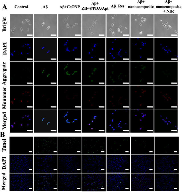 【圖五】探針在細(xì)胞水平的治療效果考察
